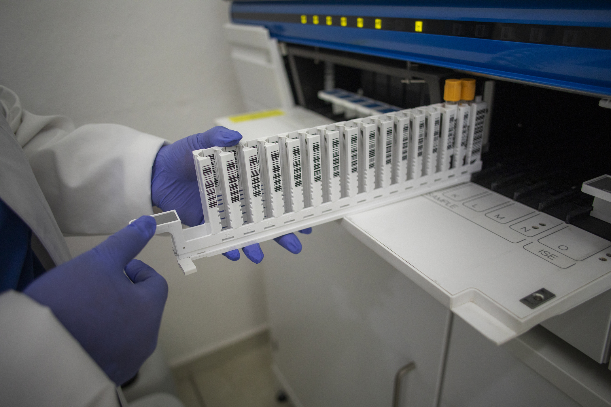 Clinical analysis laboratory test tubes